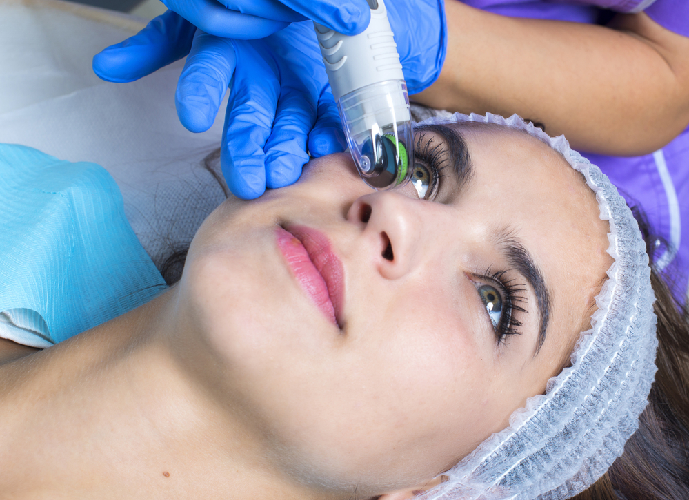 מיקרונידלינג